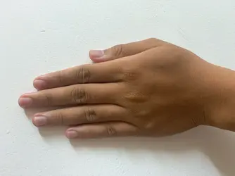 16872