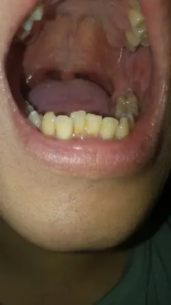 216620 216620